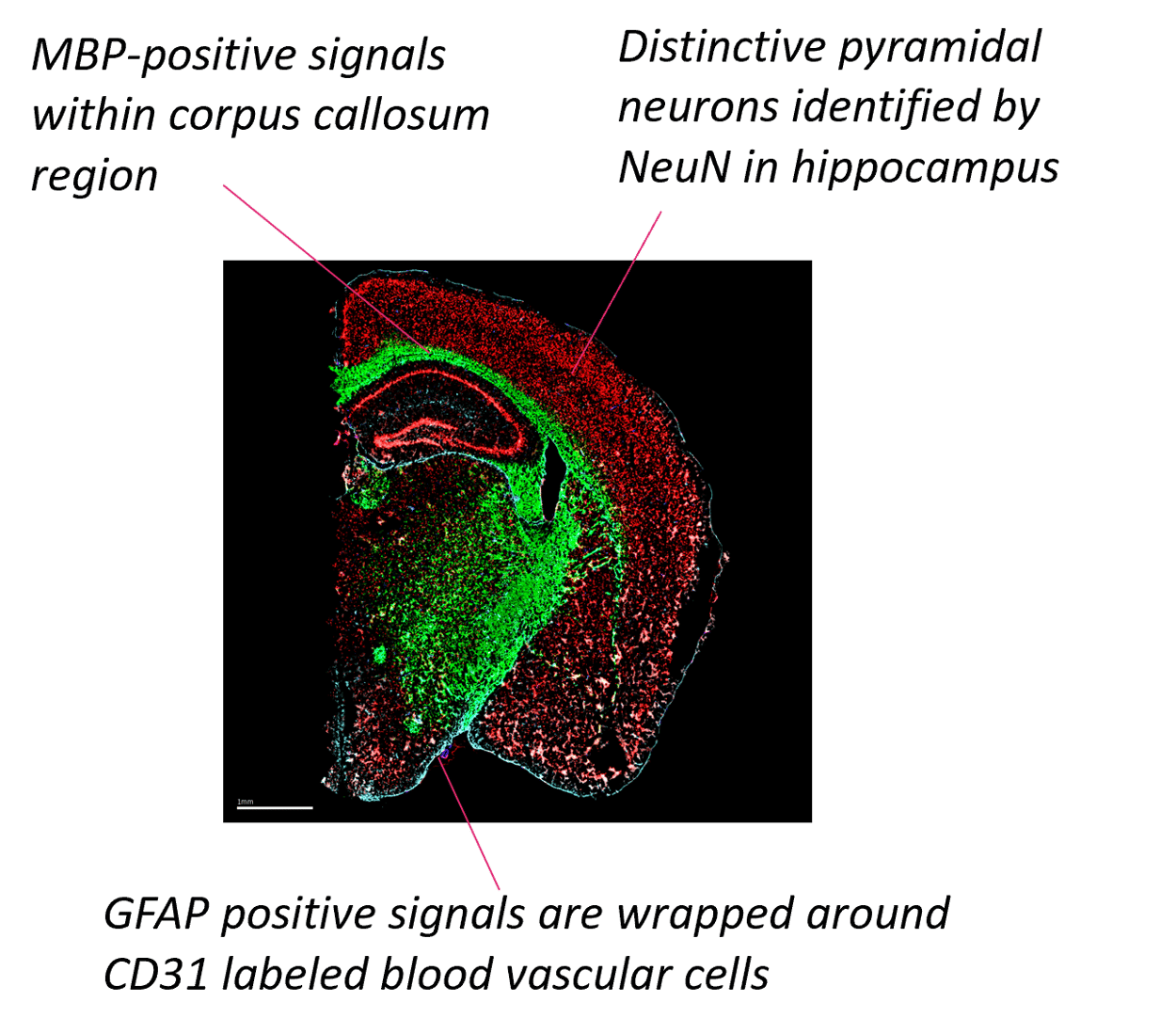Vizgen MERSCOPE Protein Co Detection